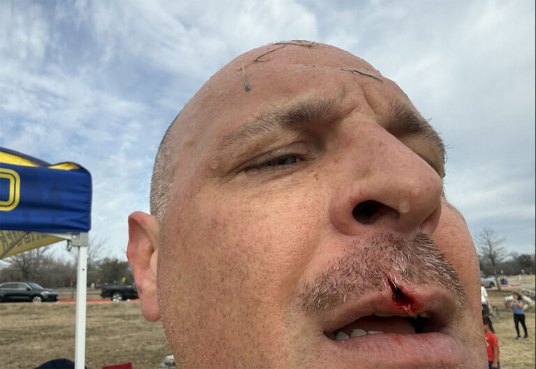 LOSS: CRU 1 – Beerca 4 – Beerca Take Down Badgers On Opening Day